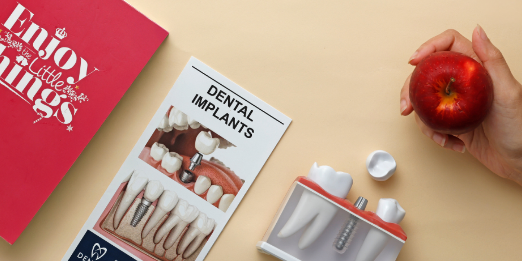 Dental Implants Near Me: Complete Patient Guide