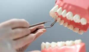 Why Should You Consider a Dental Implants Procedure?