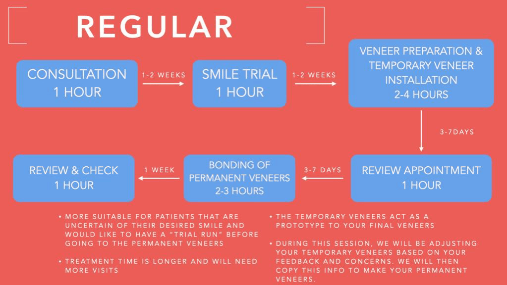 regular-veneers