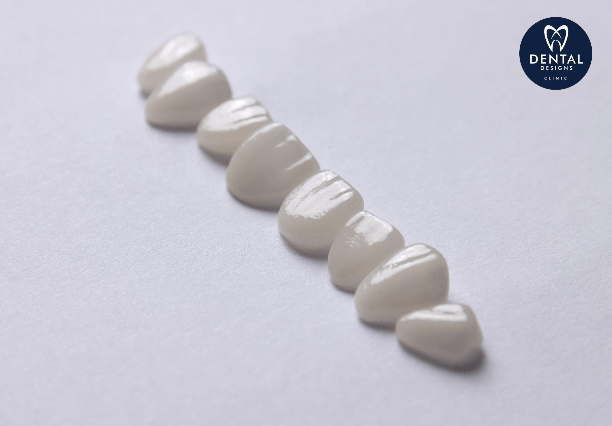 veneers
