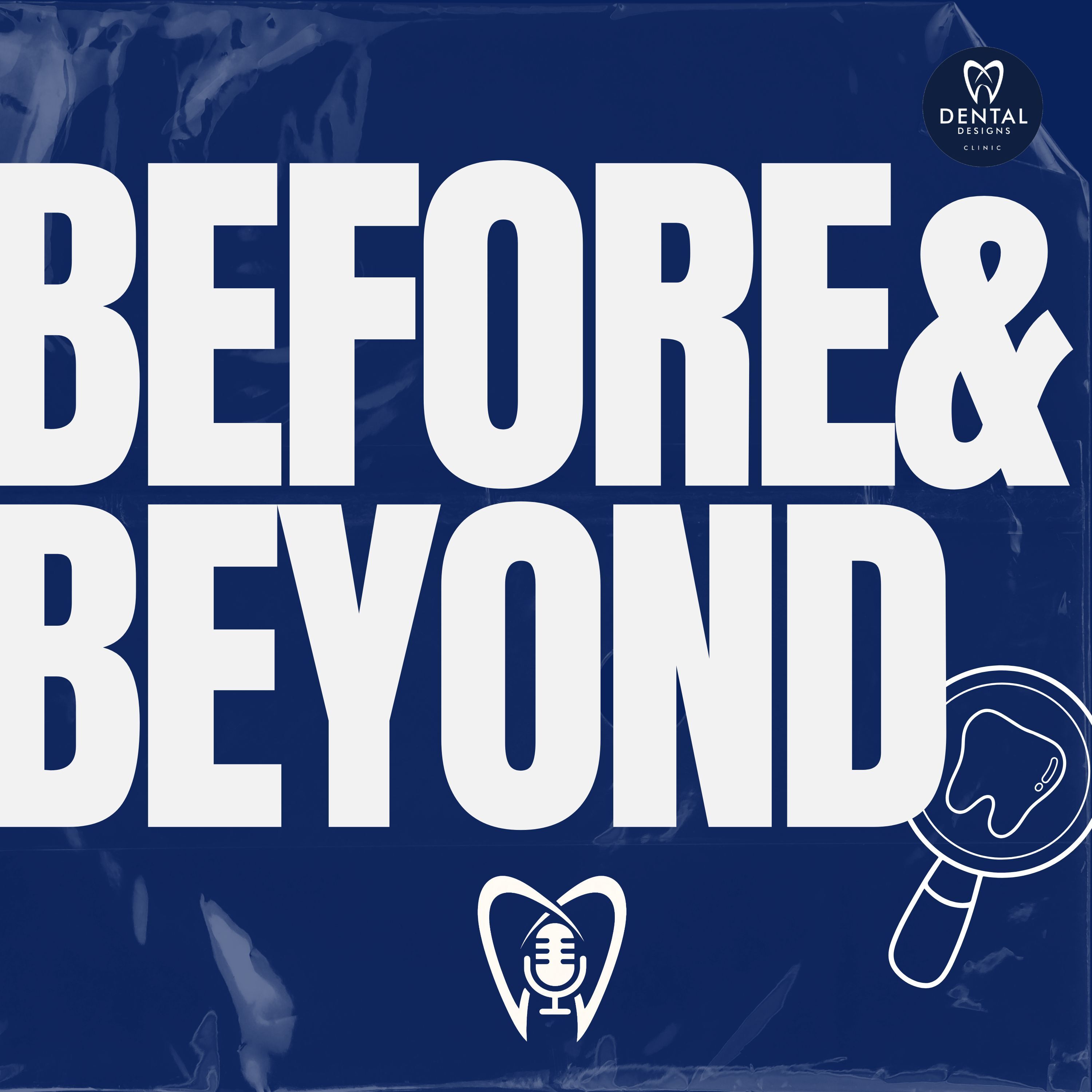Fixing A Grey Tooth for Front Tooth Discolouration (SMILE IMPROVEMENT) | BEFORE & BEYOND EP25