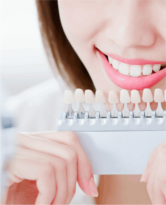Teeth Whitening