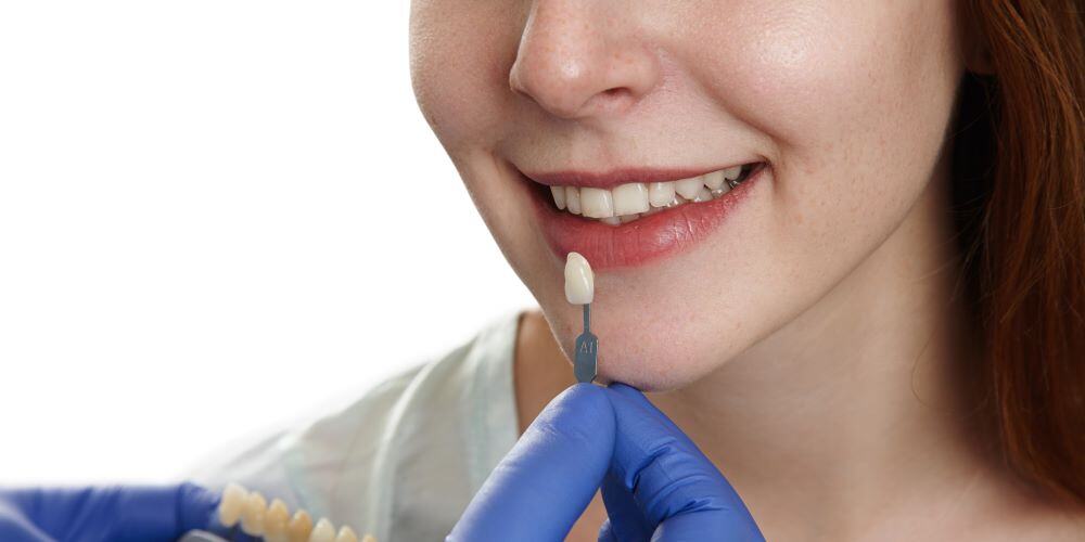 Veneer Meaning In Dentistry Dental Designs Clinic Singapore veneer-meaning-in-dentistry-dental-designs-clinic-singapore