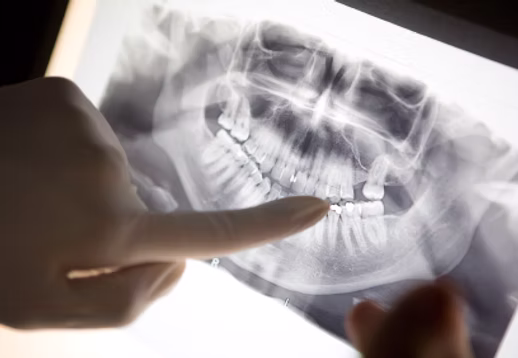consultation with xrays