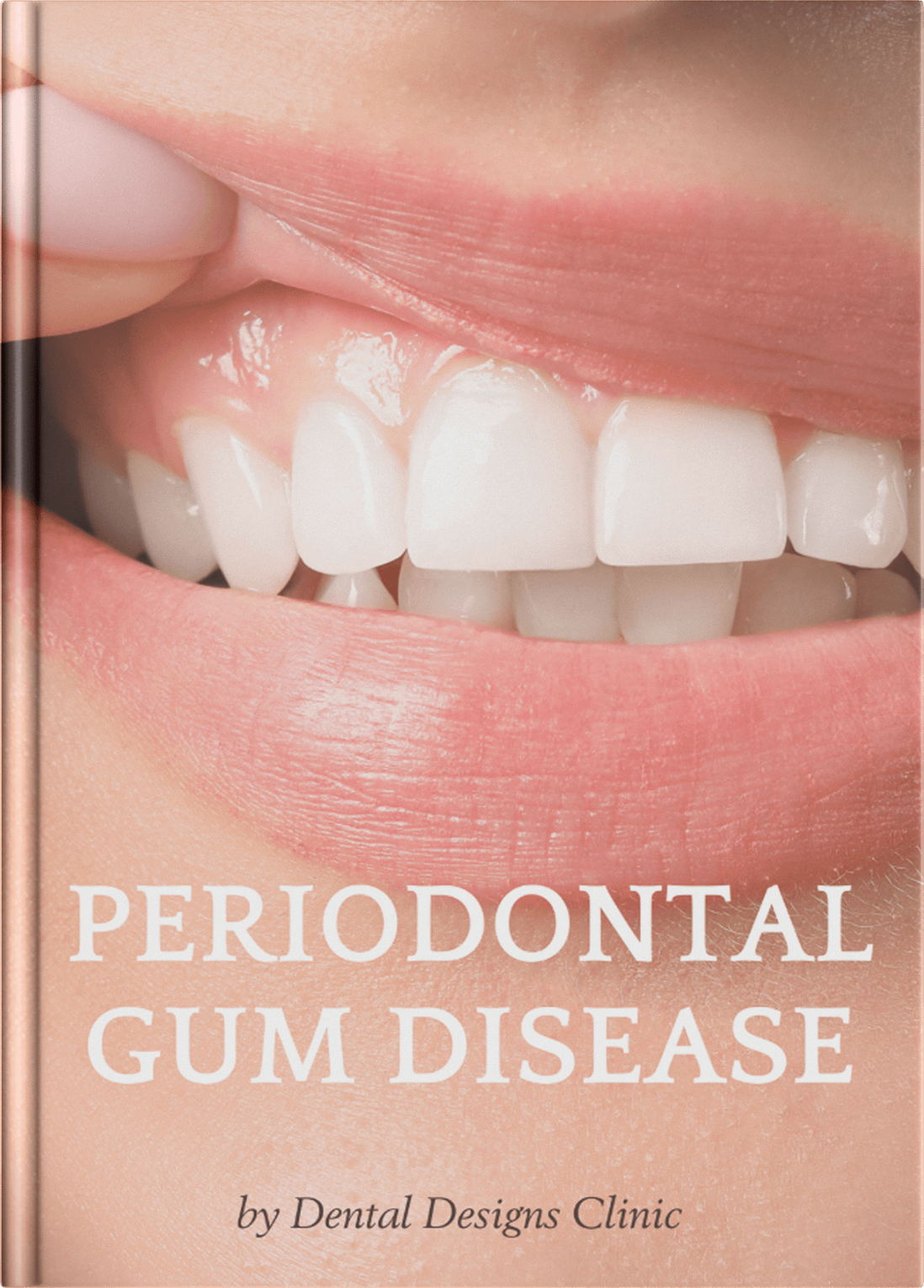 Guidebook - Periodontal Gum Disease
