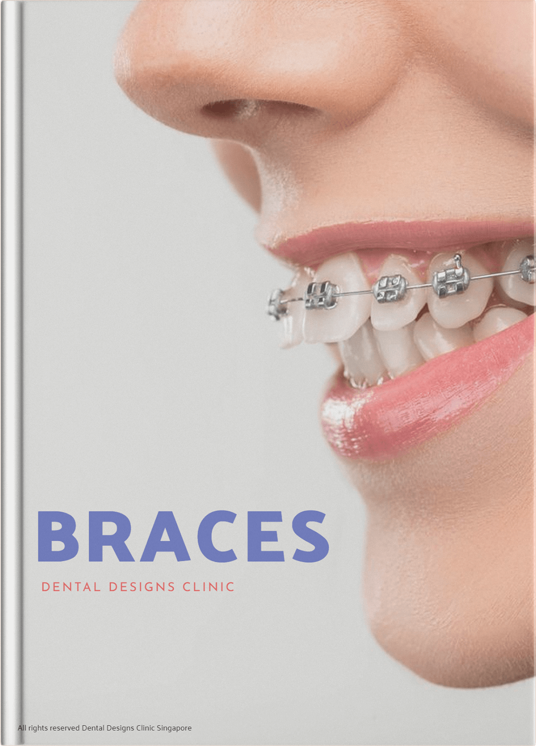Guidebook - Orthodontics (Braces)