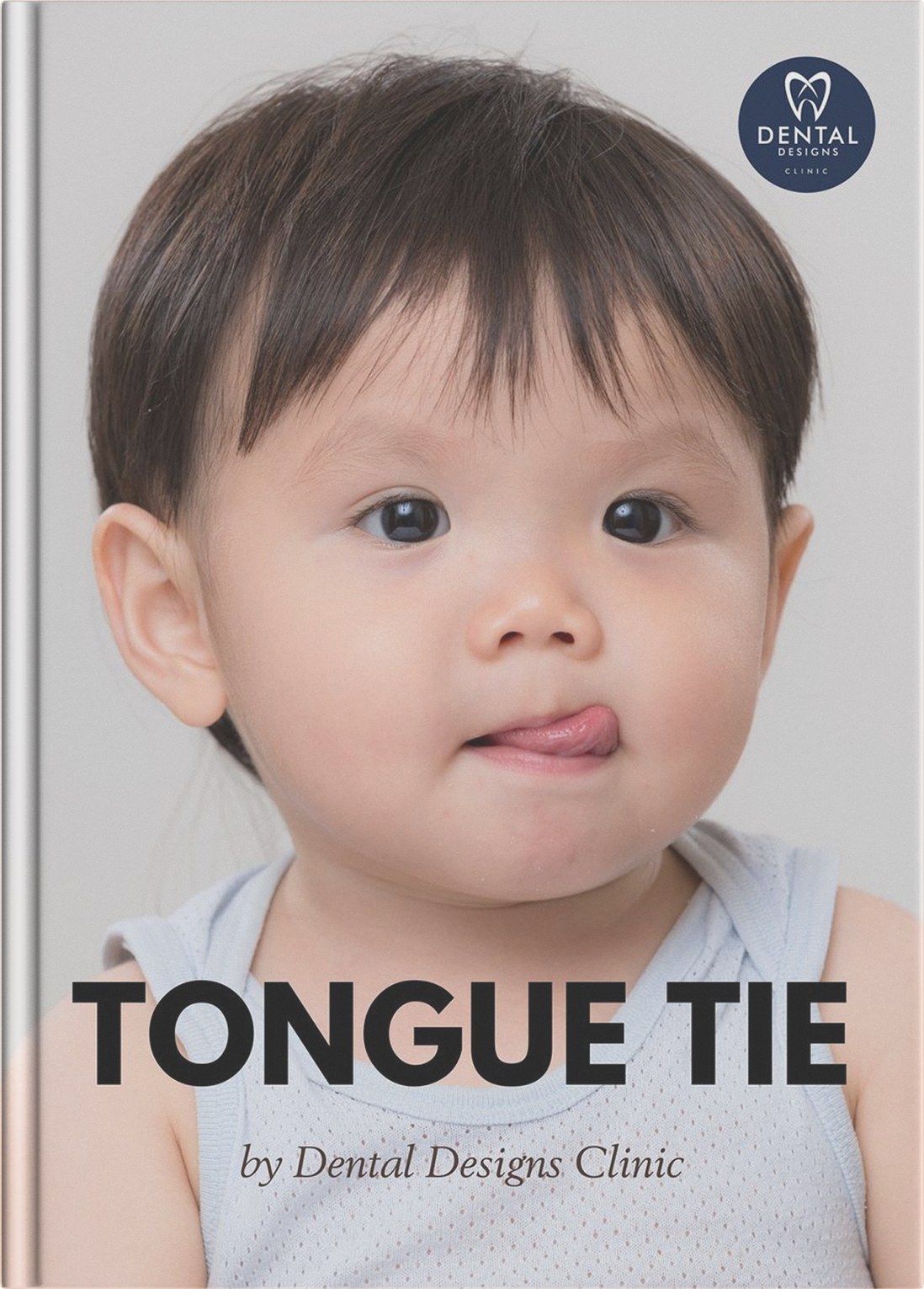 Guidebook - Laser Tongue Tie